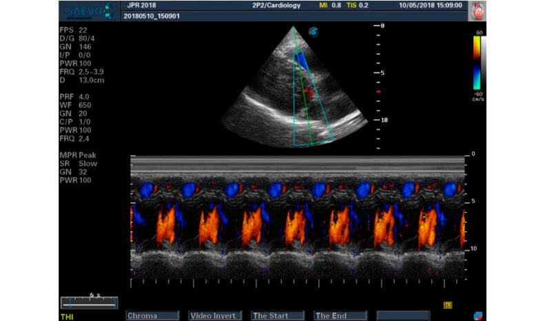 Ultrassom portátil EVUS 8 Saevo para Unidades Móveis de Saúde full
